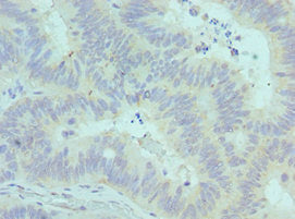 CADM1 Antibody