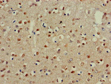 CADM3 Antibody