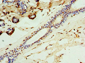 CALCB Antibody