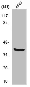VIM Antibody
