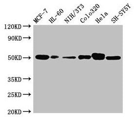 CALR Antibody