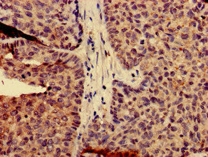 CAPN14 Antibody