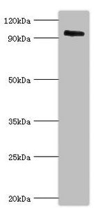 CAPN3 Antibody
