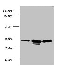 CAPZB Antibody