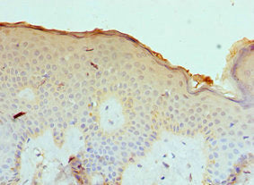 CASP14 Antibody