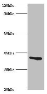 CASP6 Antibody
