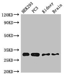 CBR1 Antibody
