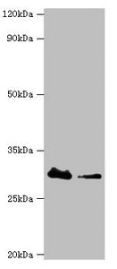 CBR3 Antibody