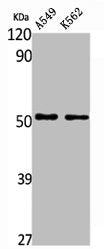 ALDH3A1 Antibody