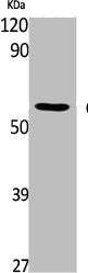 CAMK2D Antibody