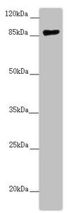 CCHCR1 Antibody