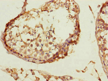 CCHCR1 Antibody