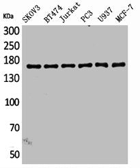 SYCP2 Antibody