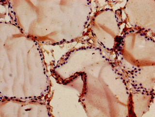 CCNT1 Antibody