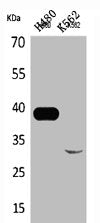 CTSL Antibody