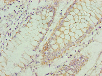 CCR1 Antibody