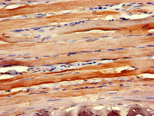 CCR10 Antibody