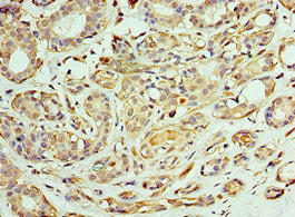 CCT6A Antibody