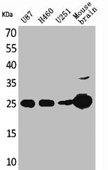 UCHL1 Antibody