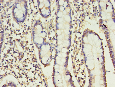 CD160 Antibody