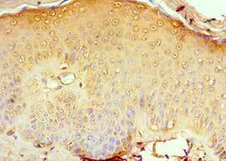 CD1A Antibody
