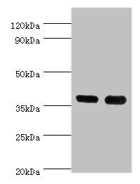 CD1A Antibody