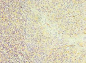 CD22 Antibody