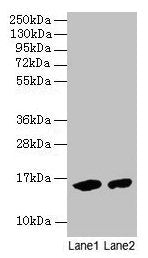 Hemoglobin Antibody