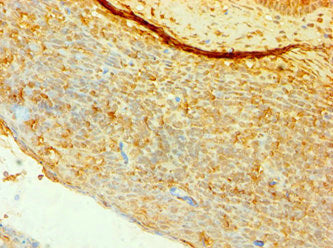 CD4 Antibody