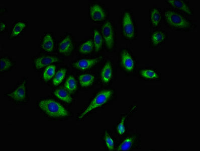 CD5 Antibody