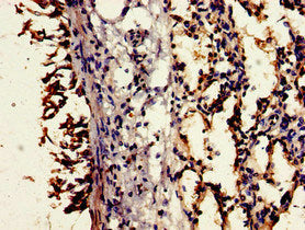 CD55 Antibody