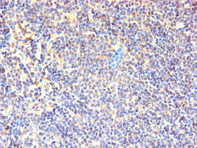 CD7 Antibody