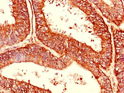 CDC34 Antibody