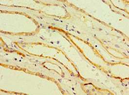 CDH16 Antibody