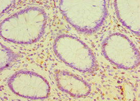 CDH16 Antibody