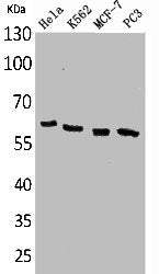 TP63 Antibody