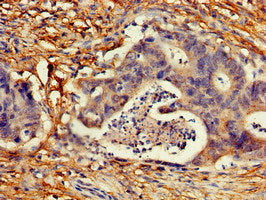 CDKN2C Antibody