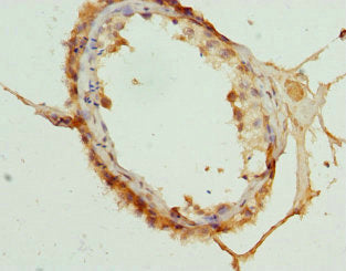 CDKN2D Antibody
