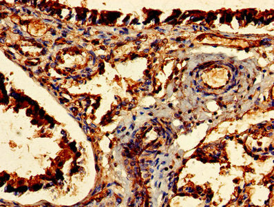 CDR2 Antibody