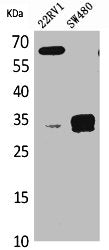SFTPA2 Antibody