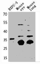 F3 Antibody