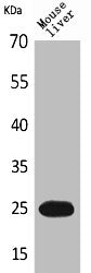 CRP Antibody
