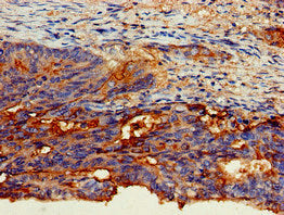 CEACAM6 Antibody