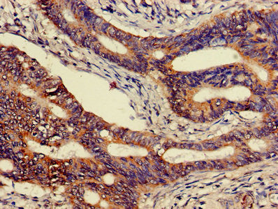CEACAM7 Antibody