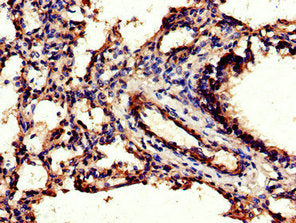 CEBPB Antibody