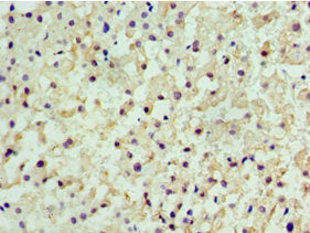 CENPQ Antibody