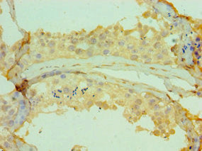 CETN2 Antibody