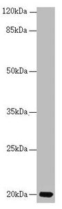 CETN3 Antibody