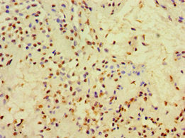 CFD Antibody