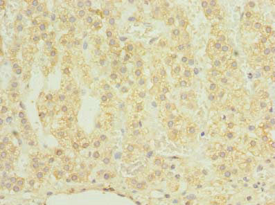 CHAD Antibody